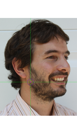 Estimación de gonion en una fotografía en vista oblicua (derecha)