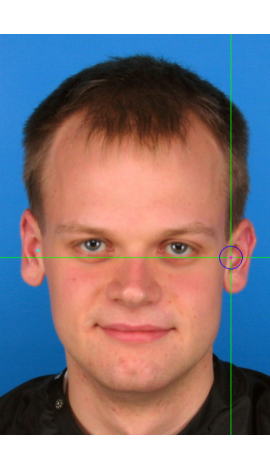 Estimacion de tragion en una imagen frontal (izquierda)