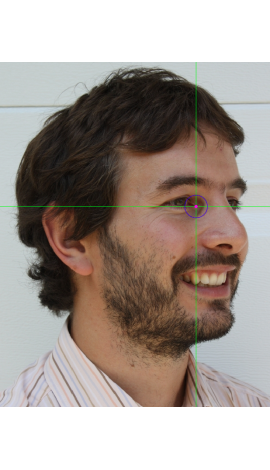 Estimación de endocanthion en una fotografía en vista oblicua (derecha)