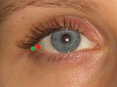 Examples of the precise marking of exocanthion (green dot) and its inaccurate placement (red dot)