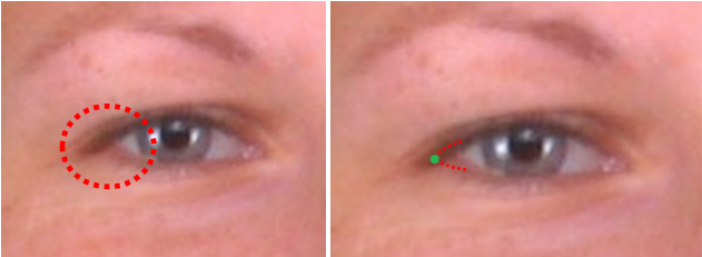Example of a photograph in which the lateral canthus of the eye is obscured by lashes (left). Estimation of the right exocanthion (right)